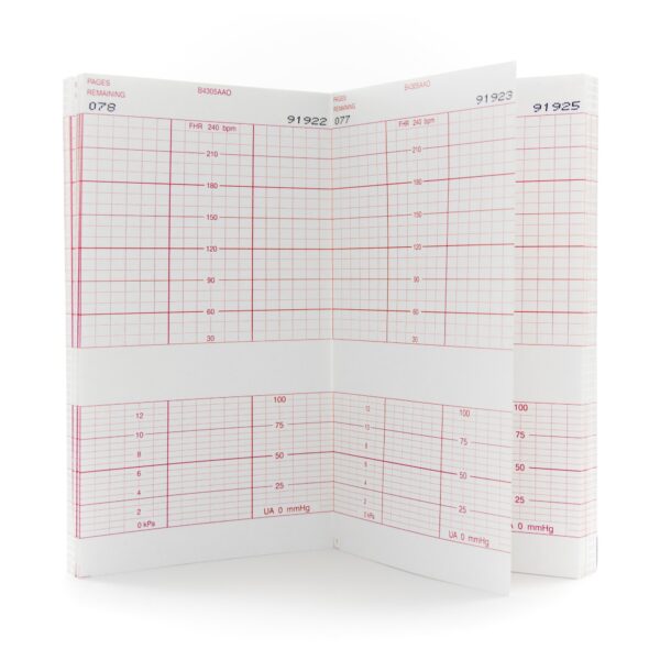 McKesson Fetal Monitoring Paper